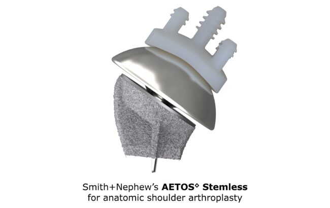 Smith+Nephew expands AETOS Shoulder System with innovative stemless implant.