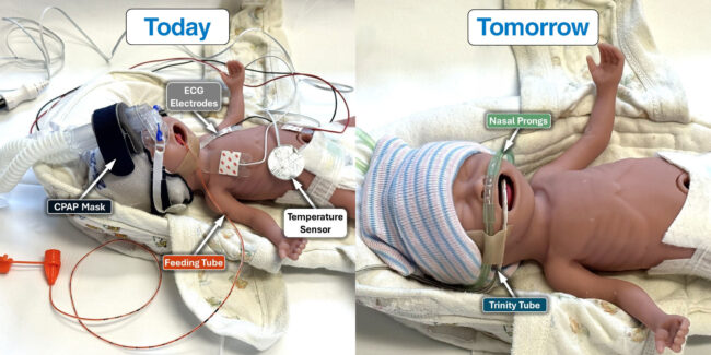 Imagine Devices and Neotech Products partner to advance multifunctional neonatal monitoring tube