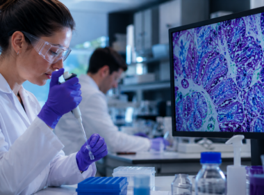 Abivax obefazimod research enters a critical NDA-stage debate as ulcerative colitis efficacy data meets investor scrutiny over safety signals. Representative image.