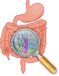 Crohn's Disease diagnosis