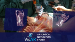 Novarad gets clearance for AR-powered VisAR surgical navigation system in Indonesia