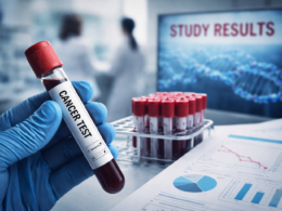 Grail’s Galleri test misses a key NHS goal. What that means for Hims & Hers Health’s strategy