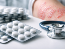 Representative image of oral psoriasis treatment, illustrating Takeda Pharmaceutical Company Limited’s zasocitinib Phase 3 results and the growing competition in once-daily plaque psoriasis pills.