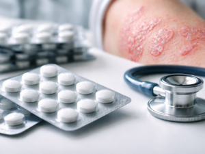 Representative image of oral psoriasis treatment, illustrating Takeda Pharmaceutical Company Limited’s zasocitinib Phase 3 results and the growing competition in once-daily plaque psoriasis pills.