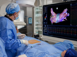 Representative image of a cardiac electrophysiology procedure, highlighting how Medtronic plc’s Affera platform, Sphere-9 catheter milestones and Sphere-360 durability data could reshape advanced cardiac ablation for atrial fibrillation and ventricular tachycardia.