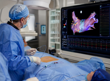 Representative image of a cardiac electrophysiology procedure, highlighting how Medtronic plc’s Affera platform, Sphere-9 catheter milestones and Sphere-360 durability data could reshape advanced cardiac ablation for atrial fibrillation and ventricular tachycardia.