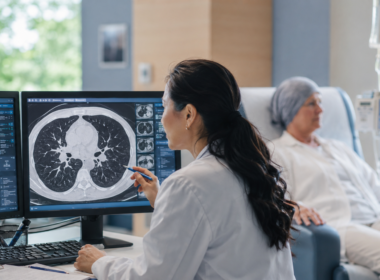 Representative image showing lung cancer imaging and oncology care, as Akeso Inc.’s ivonescimab survival results raise fresh questions about the future of standard NSCLC treatment.