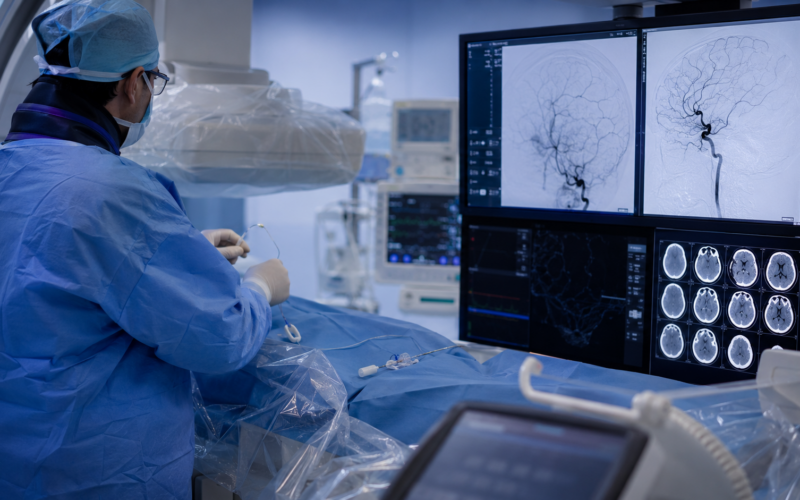 Representative image: A neurointerventional team reviews brain imaging during a stroke thrombectomy procedure, reflecting Penumbra’s THUNDERBOLT FDA clearance and the growing role of computer assisted vacuum thrombectomy in acute ischemic stroke treatment.