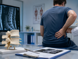 Mesoblast’s 350-patient Phase 3 rexlemestrocel-L trial has moved into its final follow-up period, putting the focus on whether its cell therapy can deliver meaningful pain reduction in chronic low back pain. Representative image.